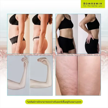 Body Slim & Fit