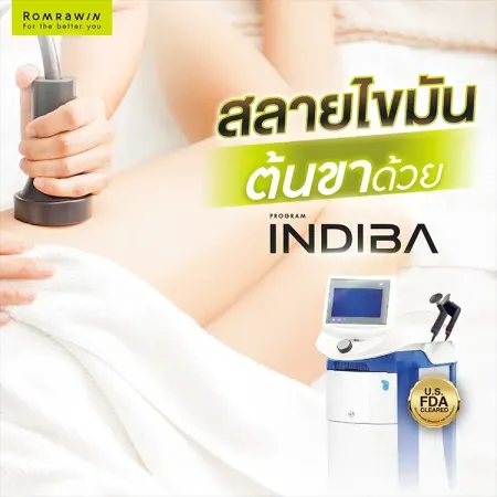สลายไขมันต้นขา Indiba