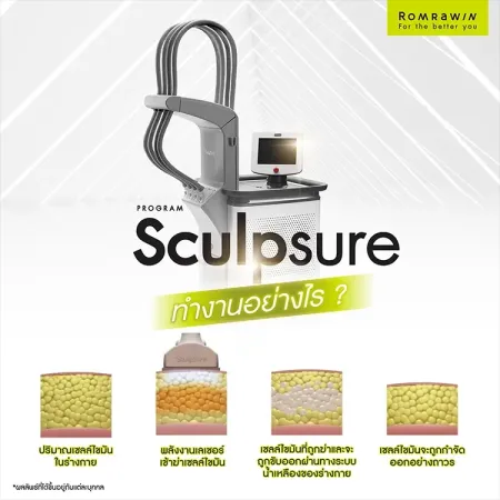 Sculpsure