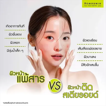 เปรียบเทียบอาการผิวหน้าแพ้สาร VS ผิวหน้าติดสเตียรอยด์ ต่างกันอย่างไร