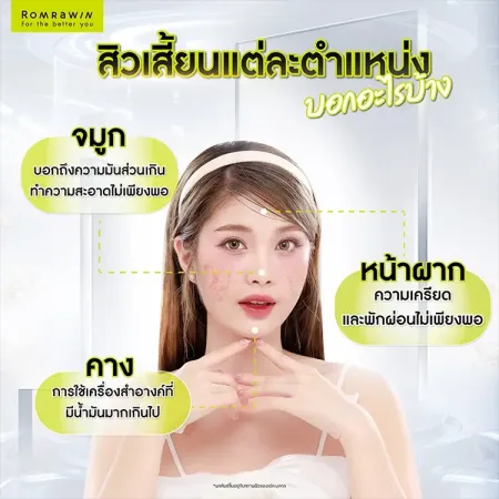 สิวเสี้ยน