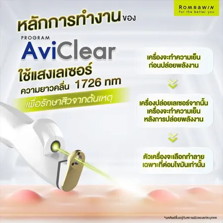 AviClear Laser
