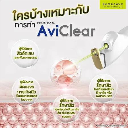 AviClear Laser
