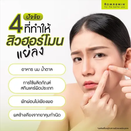 สิวฮอร์โมน