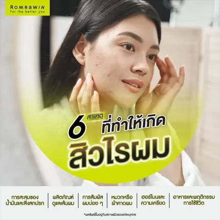 สิวไรผม