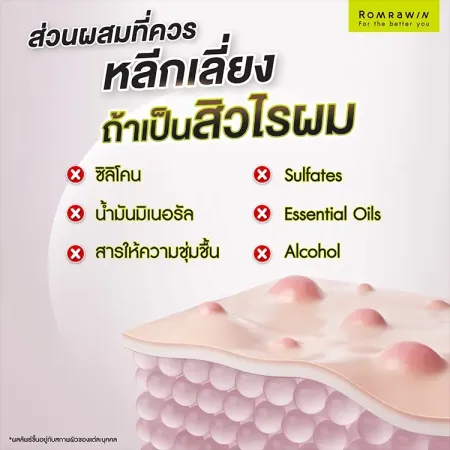 สิวไรผม