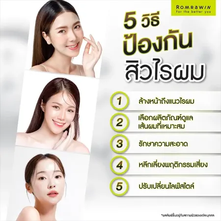สิวไรผม