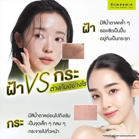 ฝ้า