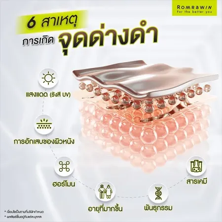 จุดด่างดำ