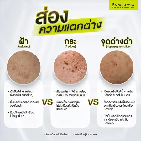จุดด่างดำ