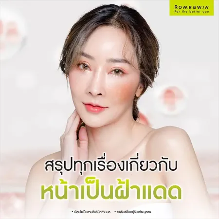 ฝ้าแดด