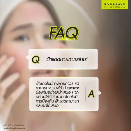 ฝ้าแดด