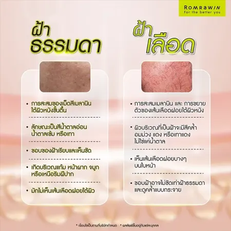 รักษาฝ้าเลือด
