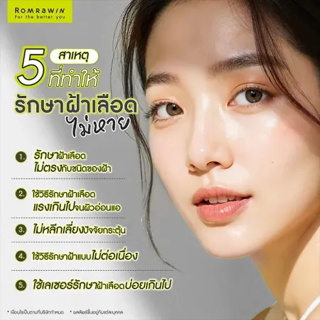 รักษาฝ้าเลือด
