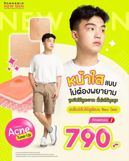 Acne Tune-Up 790