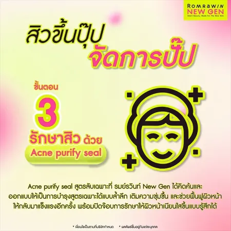 รักษาสิว Acne Tune-Up 790