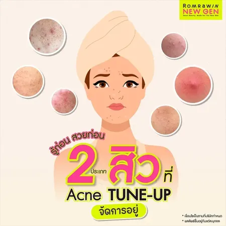 Acne Tune-Up 790