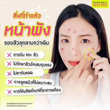 รอยแผลสิว