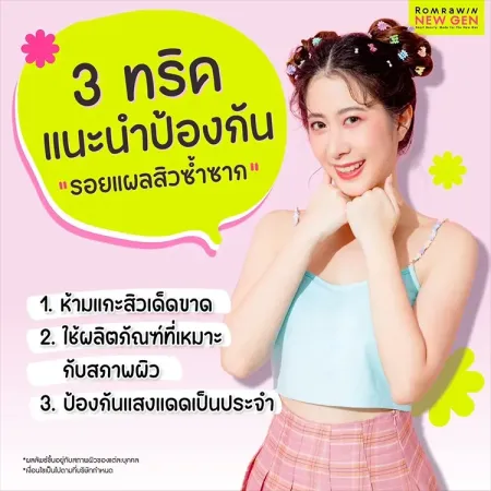 รอยแผลสิว