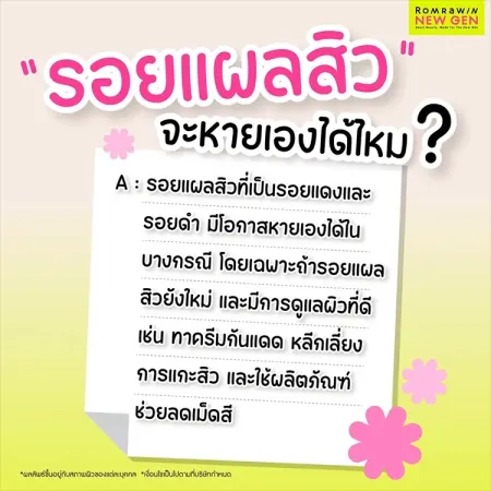 รอยแผลสิว