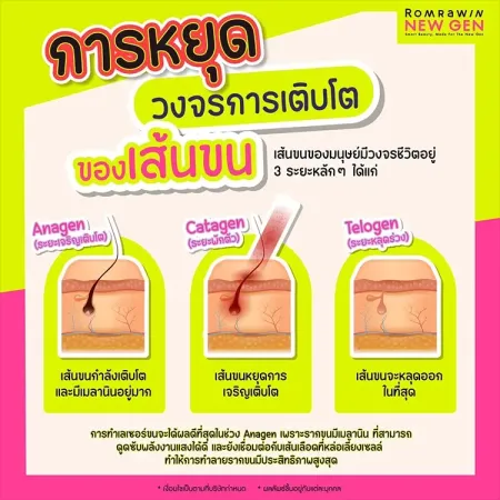 วงจรการเติบโตของเส้นขน 3 ระยะ Anagen Catagen Telogen และเลเซอร์ขน