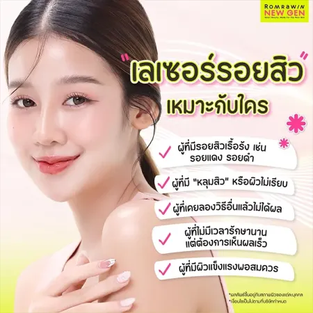 เลเซอร์รอยสิว