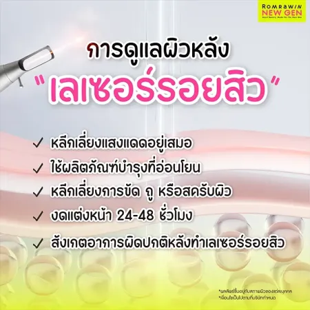 เลเซอร์รอยสิว
