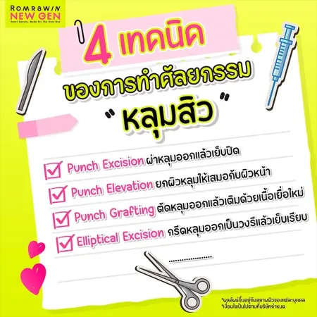 ศัลยกรรมหลุมสิว