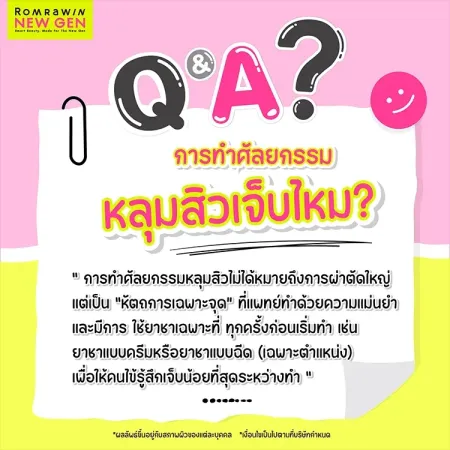 ศัลยกรรมหลุมสิว