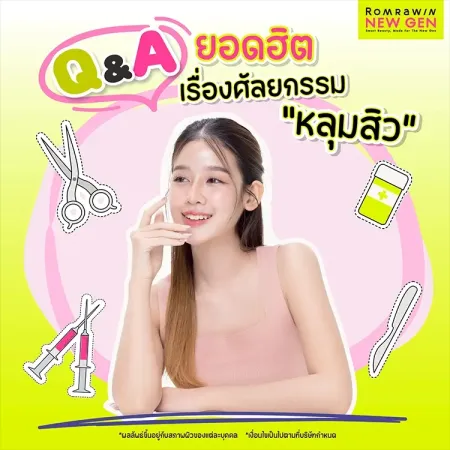 ศัลยกรรมหลุมสิว