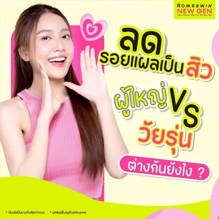 ลดรอยแผลเป็นสิว