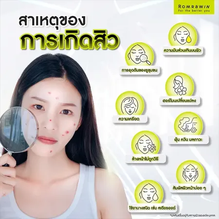 สิว