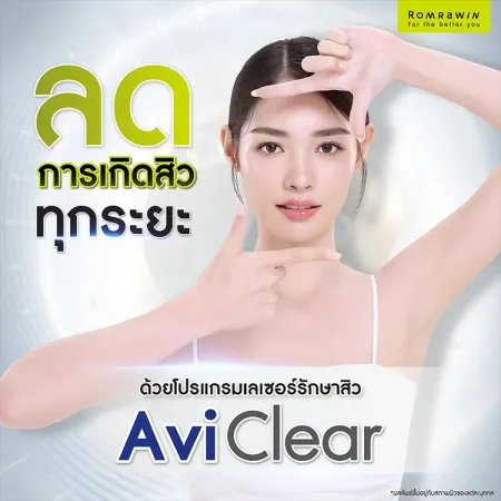 สิว