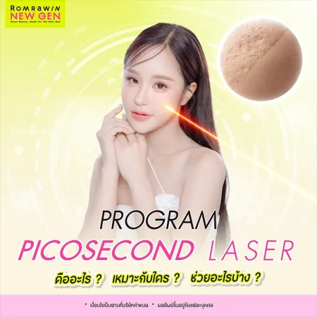 Picosecond Laser คืออะไร เหมาะกับใคร ต่างจาก Pico อื่นอย่างไร