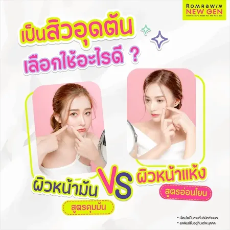สิวอุดตันใช้อะไรดี