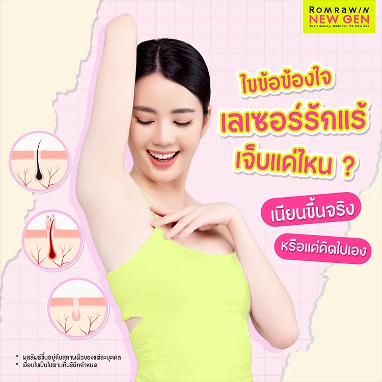 เลเซอร์รักแร้ คืออะไร กี่ครั้งเห็นผล ช่วยให้รักแร้ขาวขึ้นหรือไม่