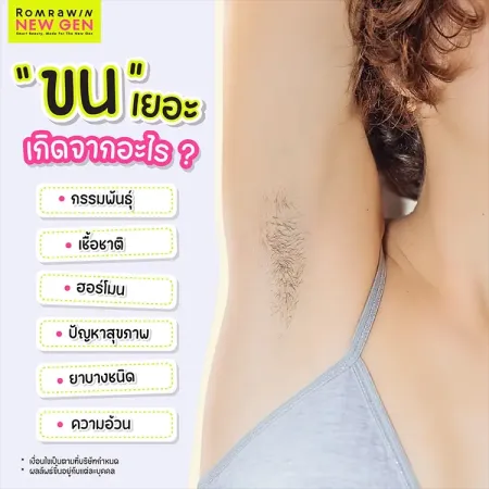 กำจัดขน