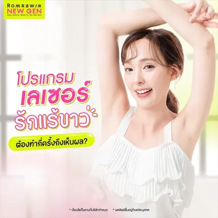 จำนวนครั้งในการทำเลเซอร์รักแร้ขาวเพื่อให้เห็นผลลัพธ์ชัดเจน