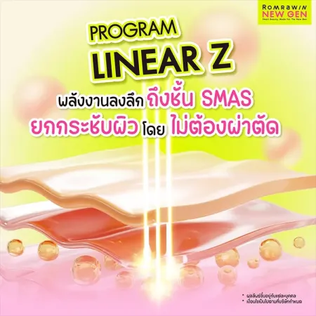 Linear Z ส่งพลังงานลงลึกถึงชั้น SMAS ยกกระชับผิวหน้าโดยไม่ต้องผ่าตัด