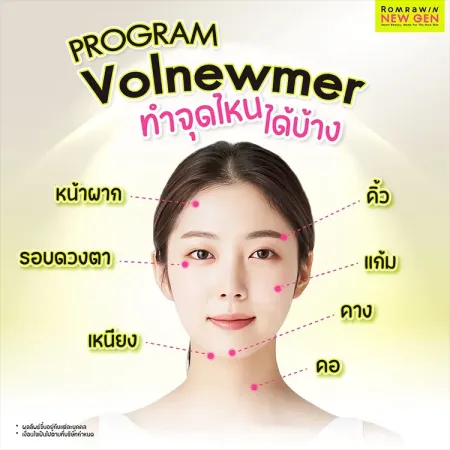 Volnewmer ทำจุดไหนได้บ้าง บริเวณที่ยกกระชับ