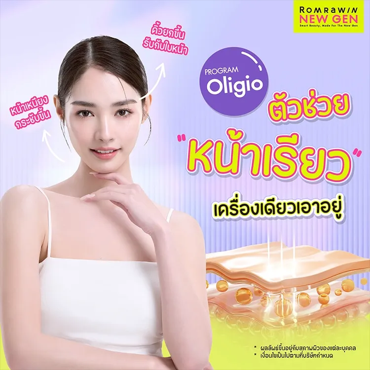 Oligio คืออะไร ยกกระชับ ลดไขมันบนหน้าแบบไม่พึ่งเข็ม
