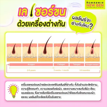 เลเซอร์ขนหน้า