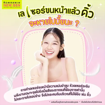 เลเซอร์ขนหน้า