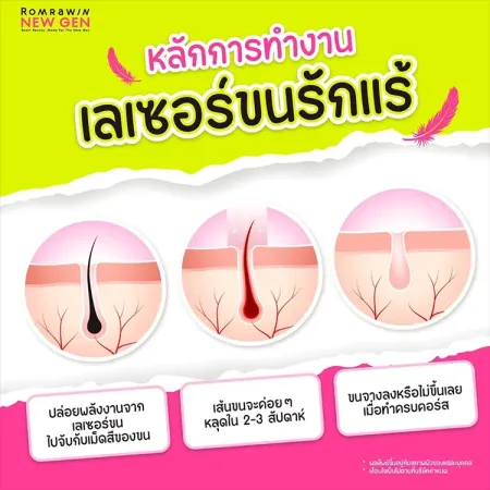 เลเซอร์ขนรักแร้ 590