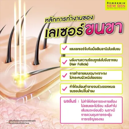 เลเซอร์ขนขา