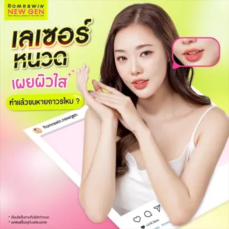 เลเซอร์หนวด คืออะไร ผู้หญิงหรือผู้ชาย ทำเลเซอร์แล้วหายถาวร