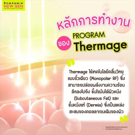 Thermage