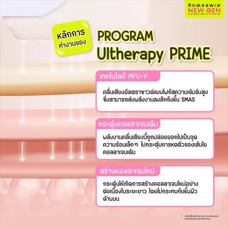 กราฟิกสีชมพูครีมหัวข้อหลักการทำงานของUltherapyPRIMEแสดงภาพจำลองชั้นผิวหนังลึกถึงชั้นSMAS