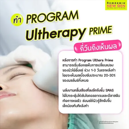 ภาพซูมเคสคนไข้ขณะทำUltherapyPRIMEระบุข้อความกล่องข้อมูลอธิบายระยะเวลาการเห็นผลหลังทำ