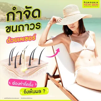 กำจัดขนถาวร ต้องทำกี่ครั้งถึงเห็นผล เตรียมตัวอย่างไร